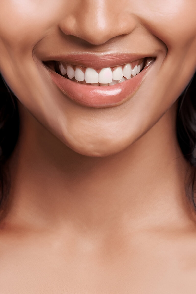 A woman showing her bright smile restored with dental implants at Bright Dental.