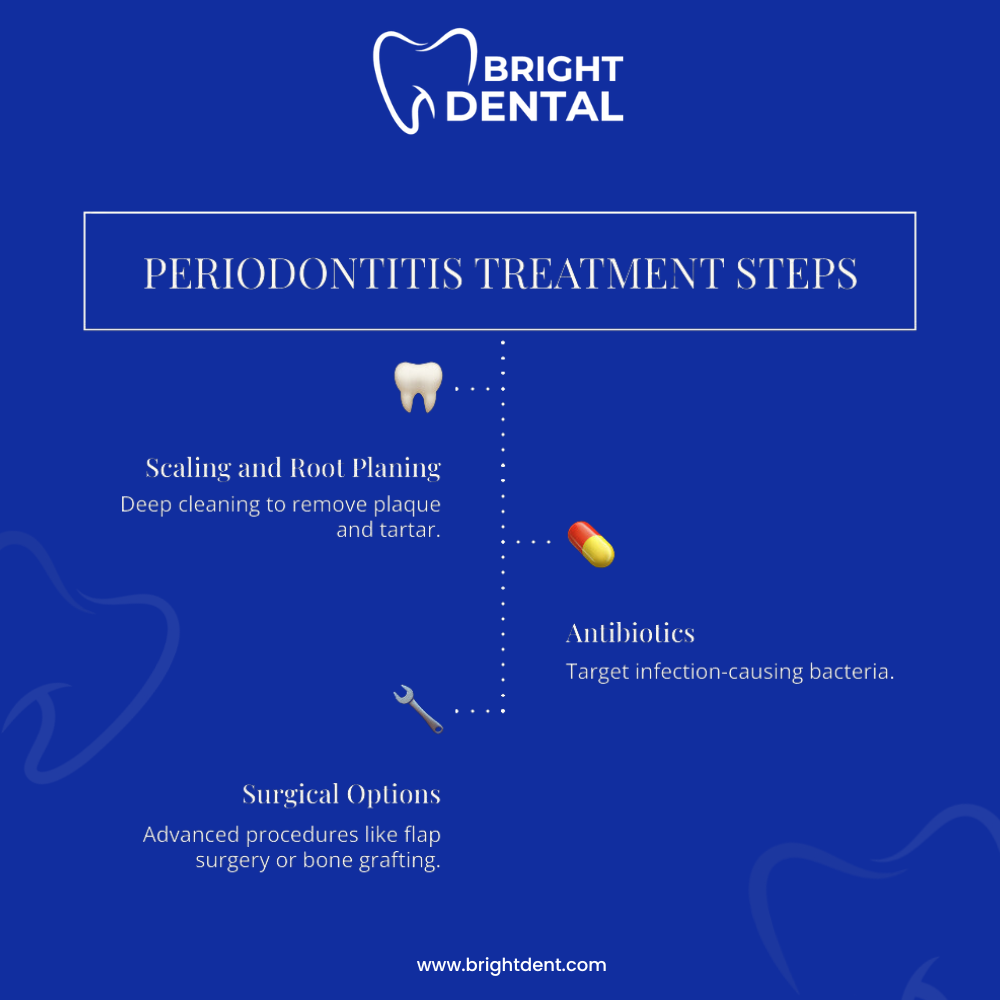 Periodontitis Treatment