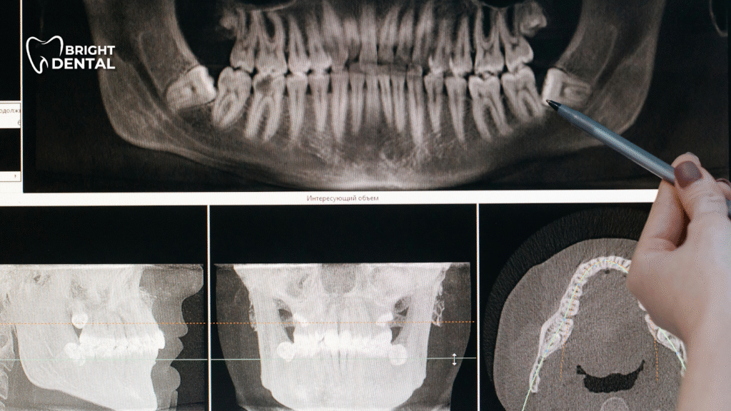 Digital teeth scan