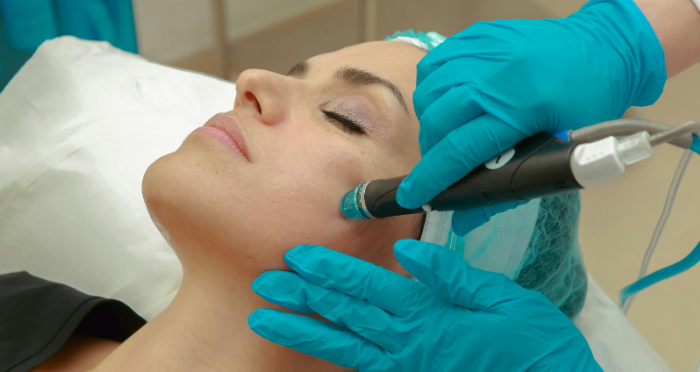 Non-Surgical Cosmetic Treatments