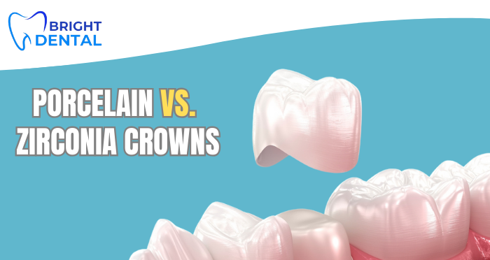 Porcelain vs. Zirconia Crowns