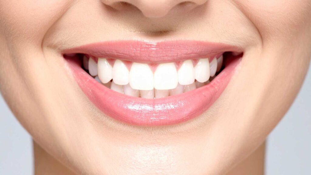 natural teeth whitening remedies