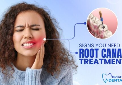 Patient experiencing severe tooth pain requiring root canal treatment in Des Plaines