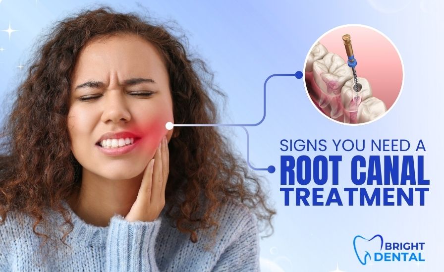 Patient experiencing severe tooth pain requiring root canal treatment in Des Plaines