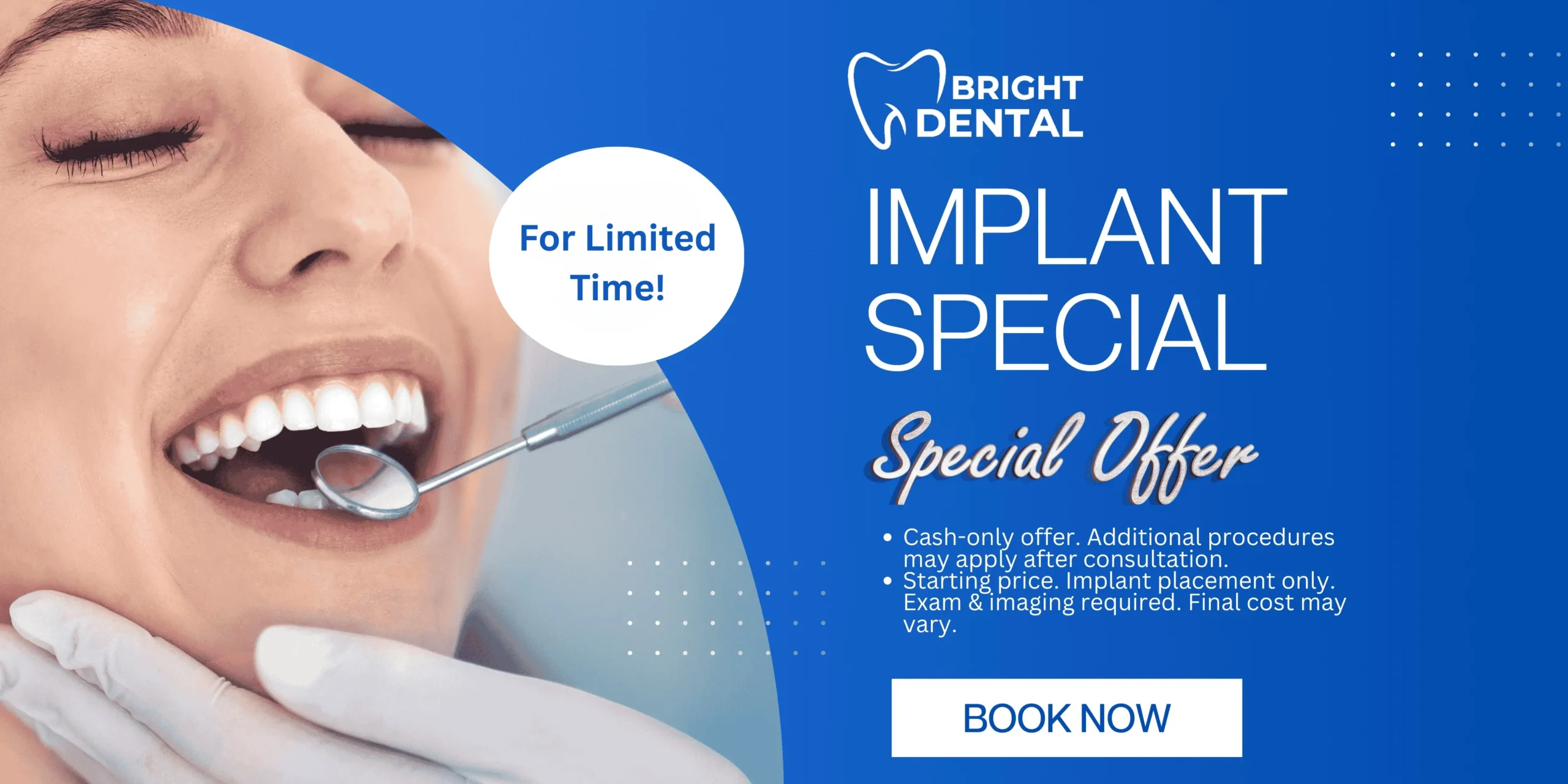 Dental implant special offer advertisement.