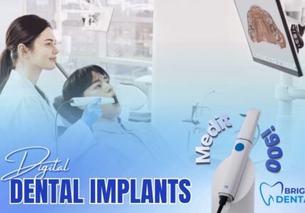 Digital Dental Implants Des Plaines