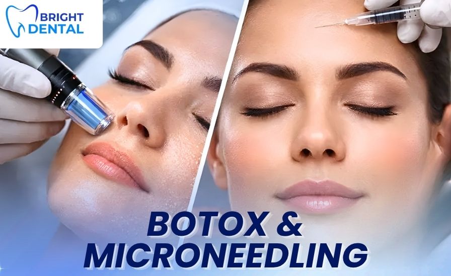 Botox and microneedling