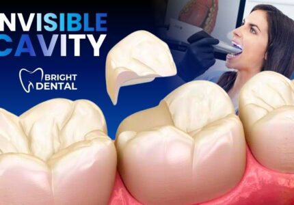 "Invisible" Cavity 3d scan