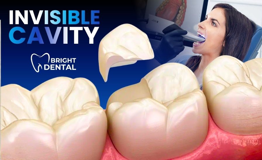 "Invisible" Cavity 3d scan