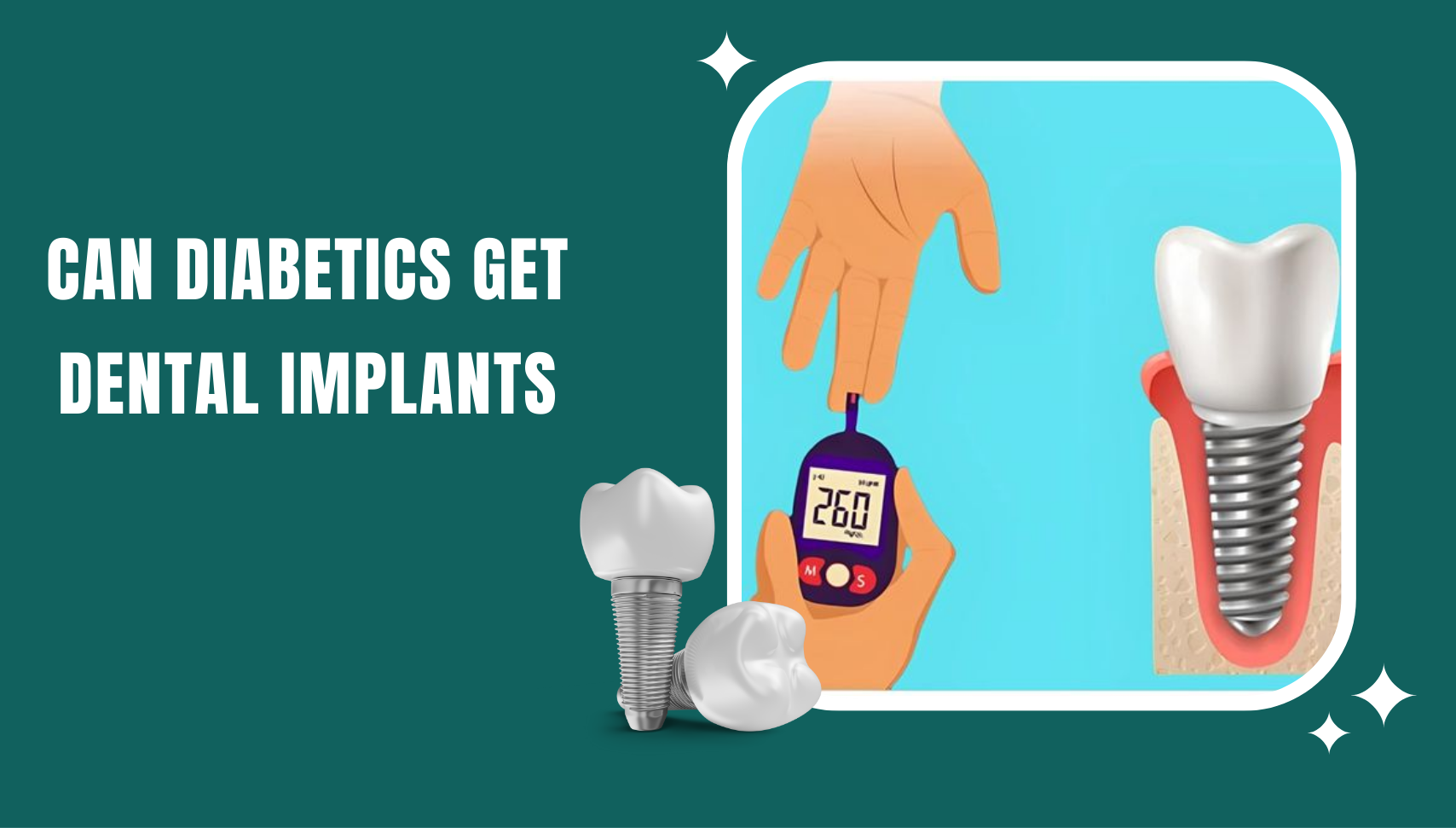 Dental Implants with Diabetes