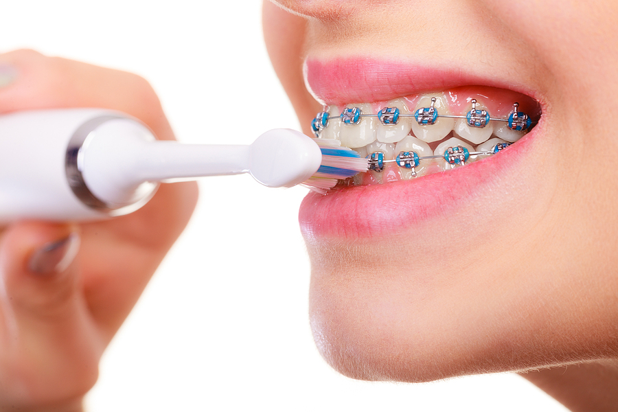 Electric vs Manual Toothbrush for Braces