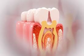 How Reduced Chewing Function Accelerates Bone Loss