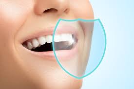 teeth whitening in des plaines