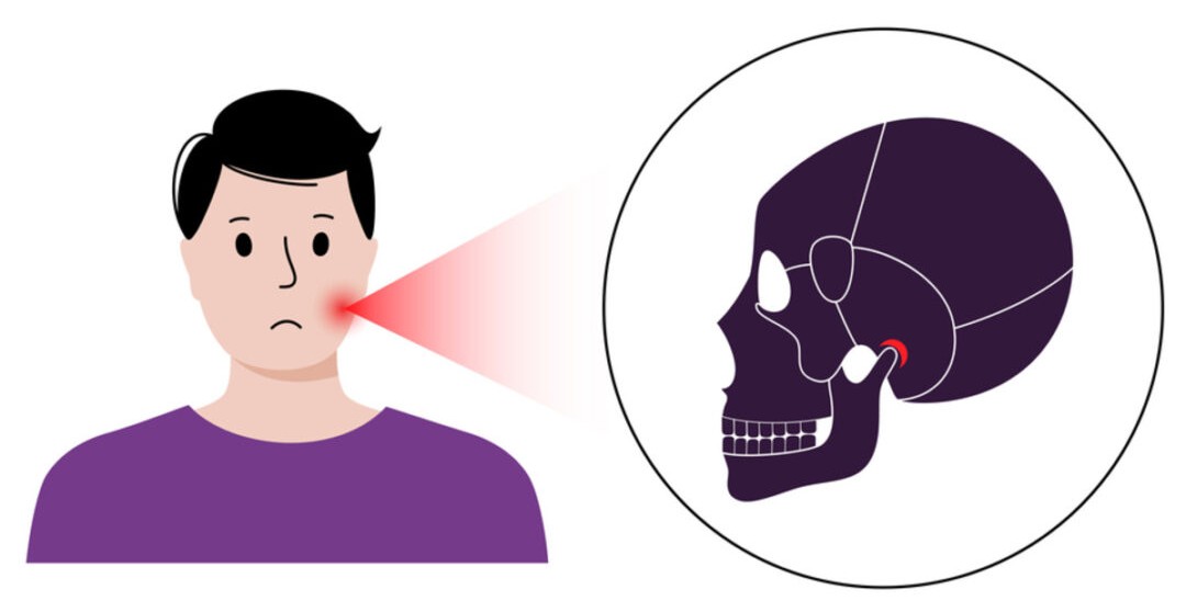 TMJ Pain and Dentistry