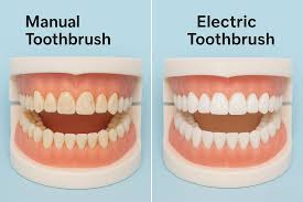 Plaque Removal