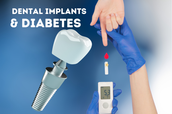 Dental Implants with Diabetes
