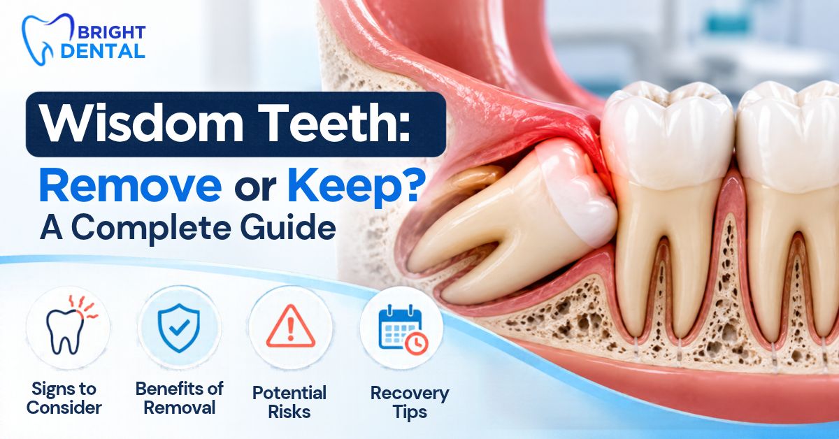 Wisdom teeth removal or retention guide showing an impacted wisdom tooth, signs to consider, benefits of removal, potential risks, and recovery tips.