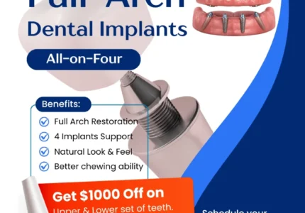 all-on-4 dental implants des plaines il bright dental