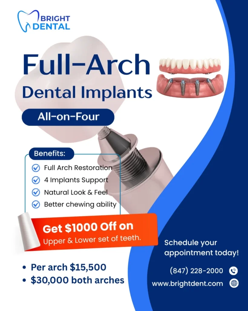 all-on-4 dental implants des plaines il bright dental