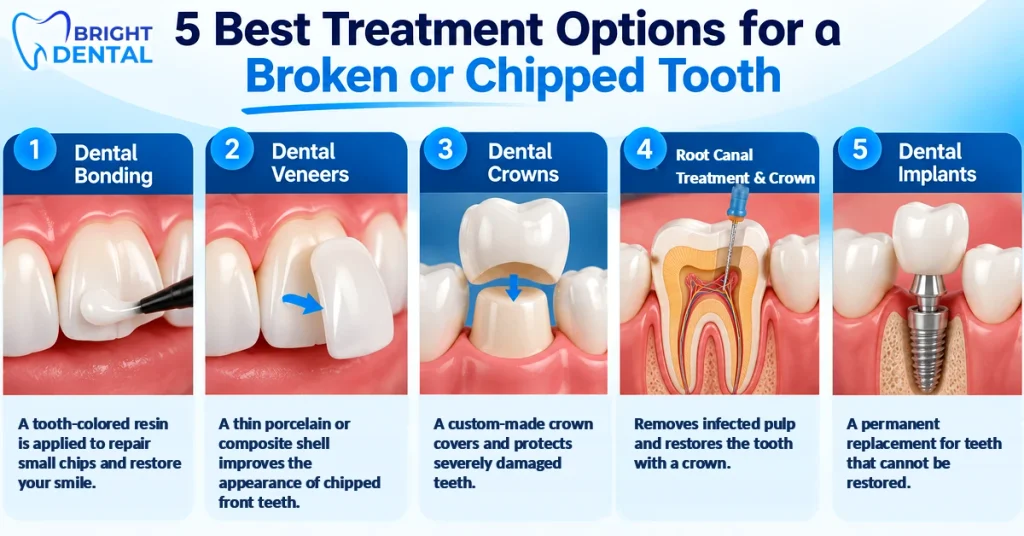 Infographic of 5 treatment options for a broken or chipped tooth: dental bonding, dental veneers, dental crowns, root canal treatment and crown, and dental implants