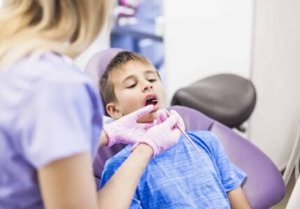 Dental Sealants for Kids