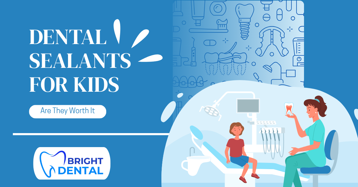 dental sealants for kids