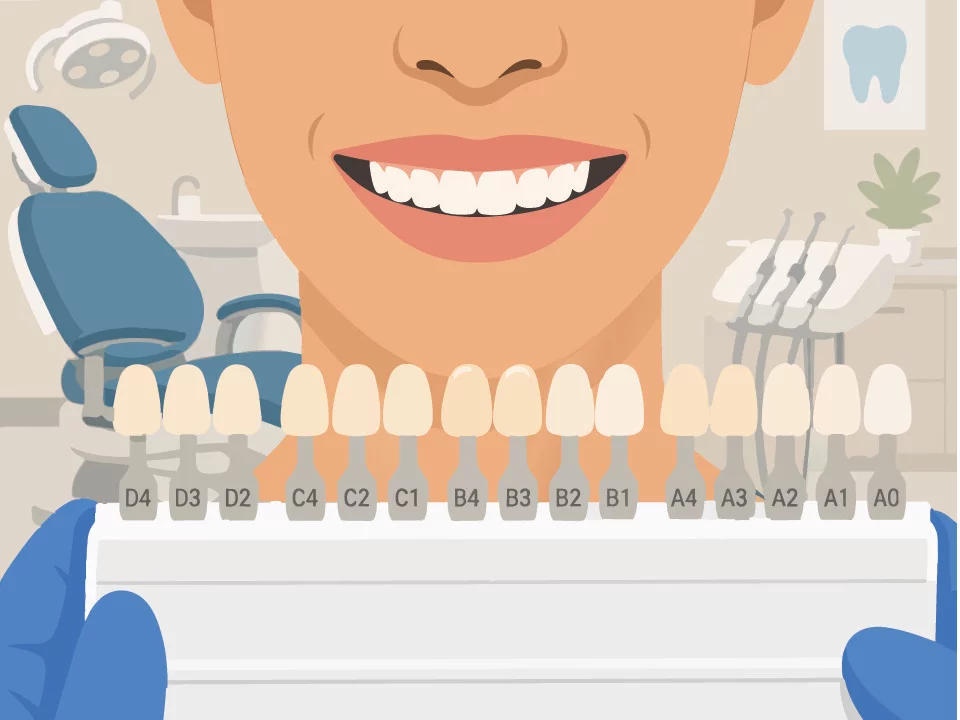 Dental Veneers Cost