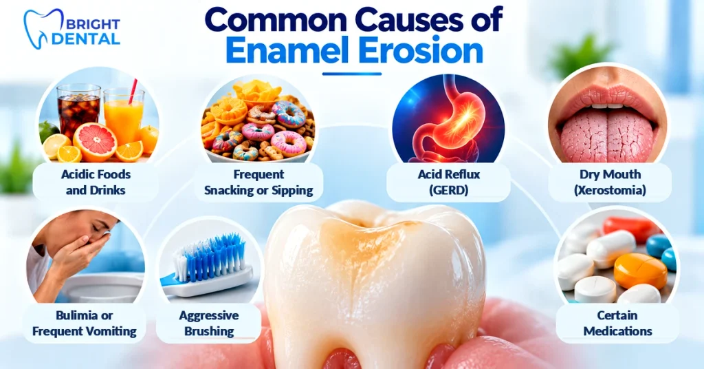 Infographic showing common causes of enamel erosion: acidic foods and drinks, frequent snacking or sipping, acid reflux (GERD), dry mouth (xerostomia), bulimia or frequent vomiting, aggressive brushing, and certain medications