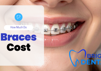 how much do braces cost