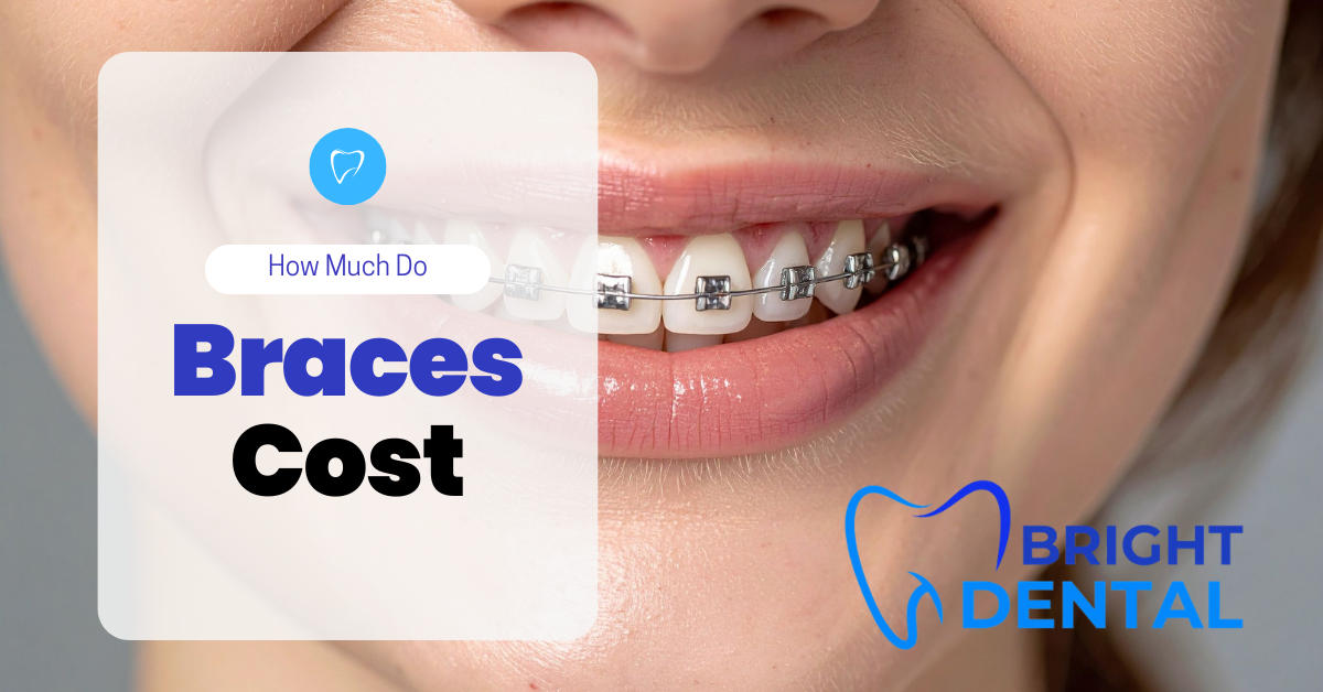 how much do braces cost