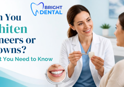Dentist comparing shade of whitened natural teeth to porcelain veneers and crowns at Bright Dental