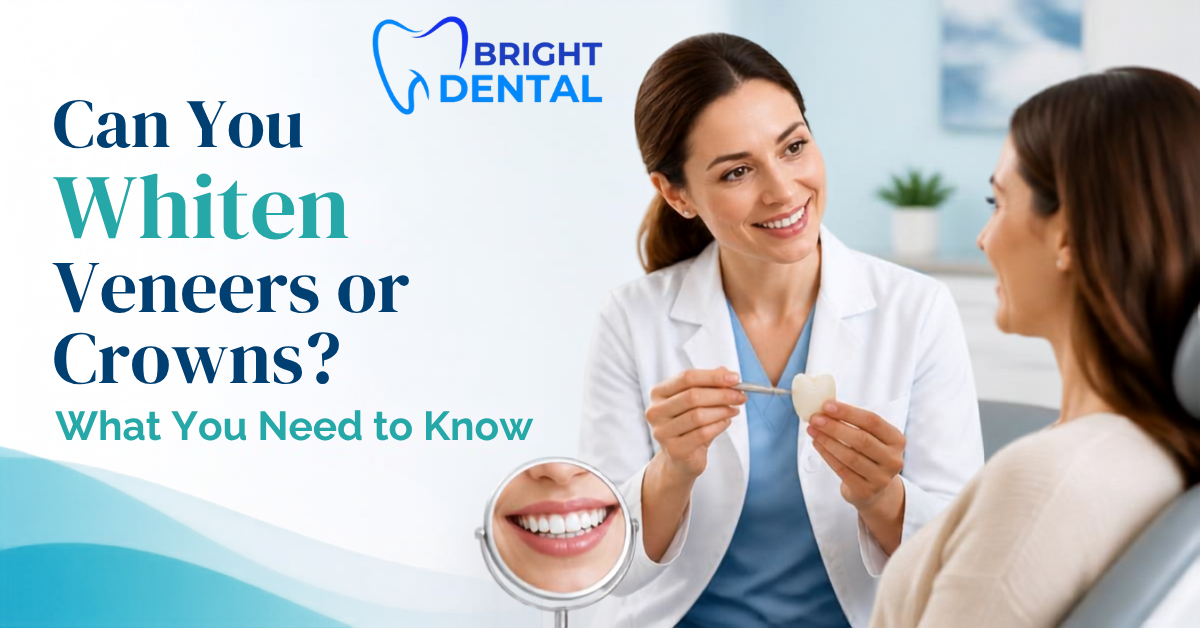 Dentist comparing shade of whitened natural teeth to porcelain veneers and crowns at Bright Dental