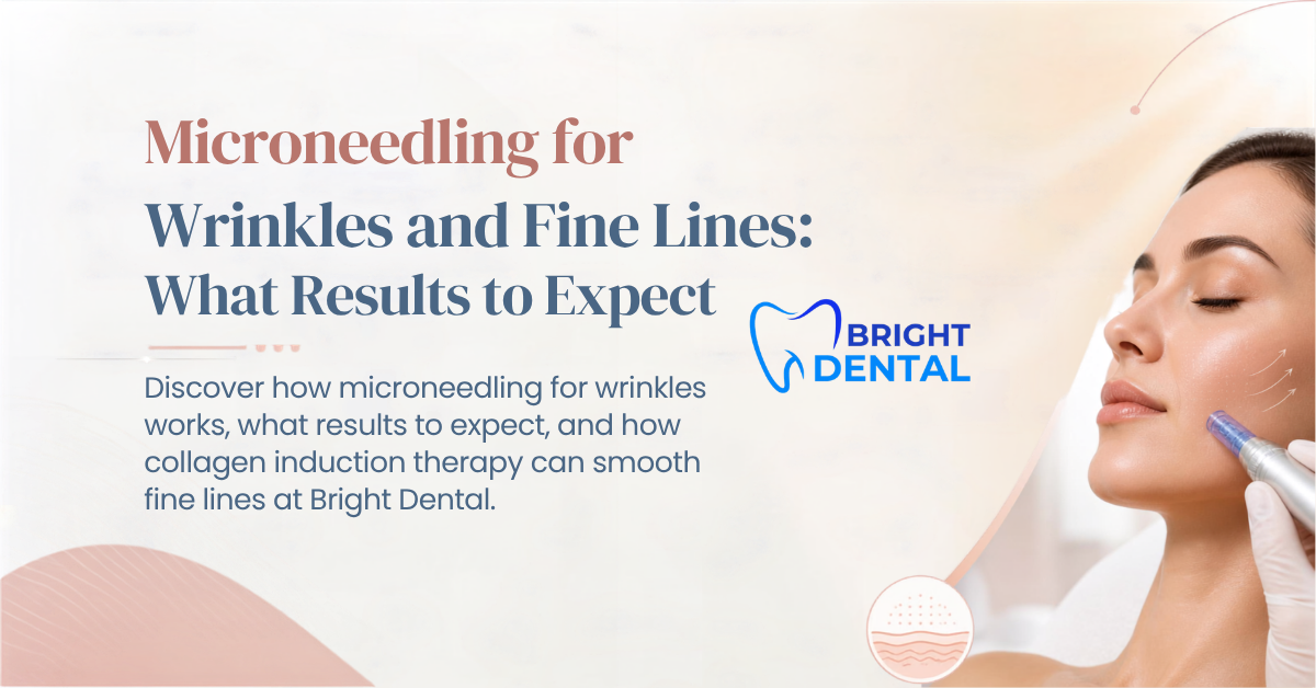 Microneedling treatment for fine lines and wrinkles performed at Bright Dental in Des Plaines, IL