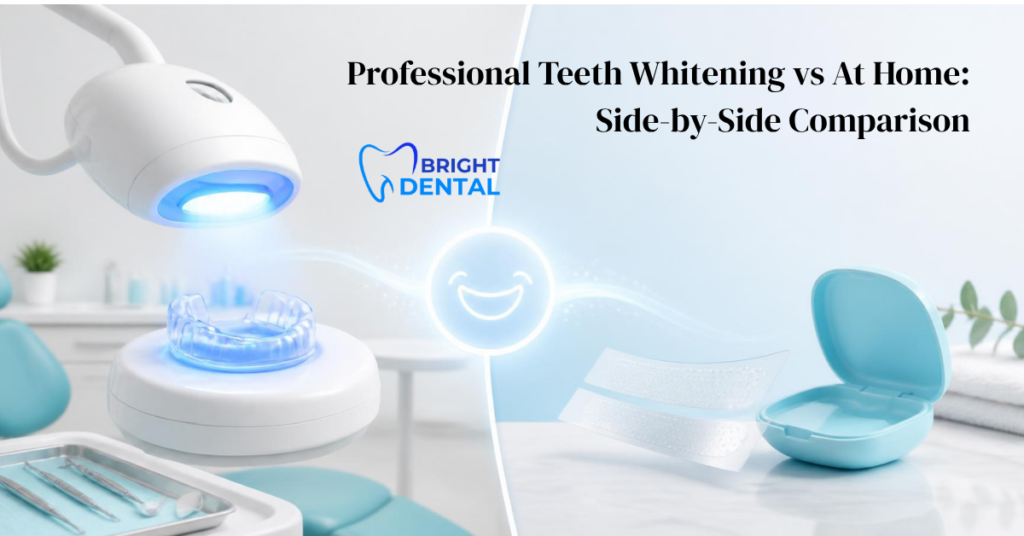 Professional Teeth Whitening vs At Home 