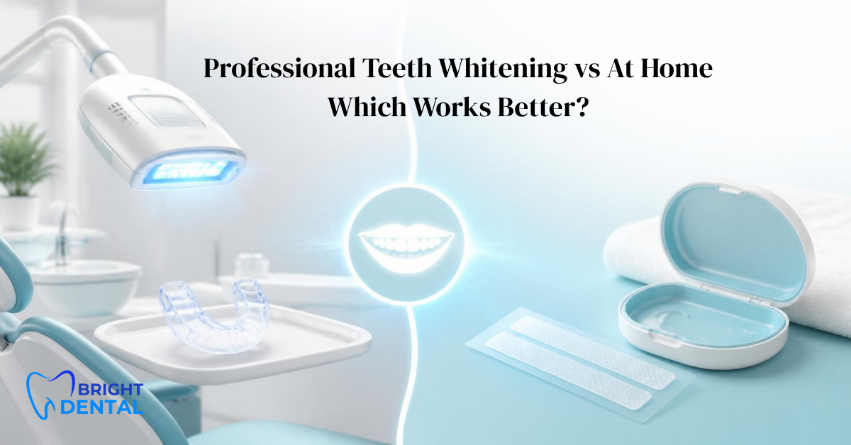 Professional Teeth Whitening vs At Home