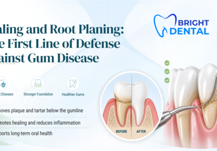Scaling and Root Planing