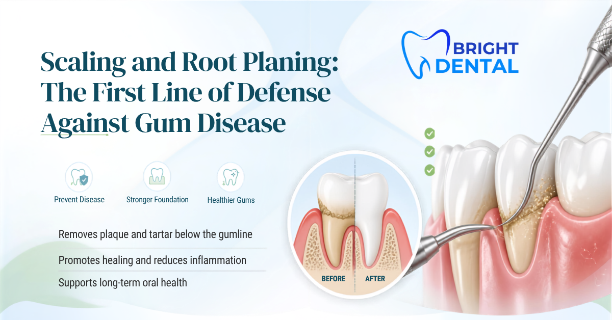 Scaling and Root Planing