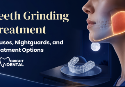 teeth grinding treatment
