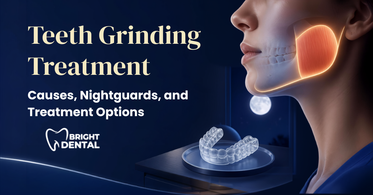 teeth grinding treatment