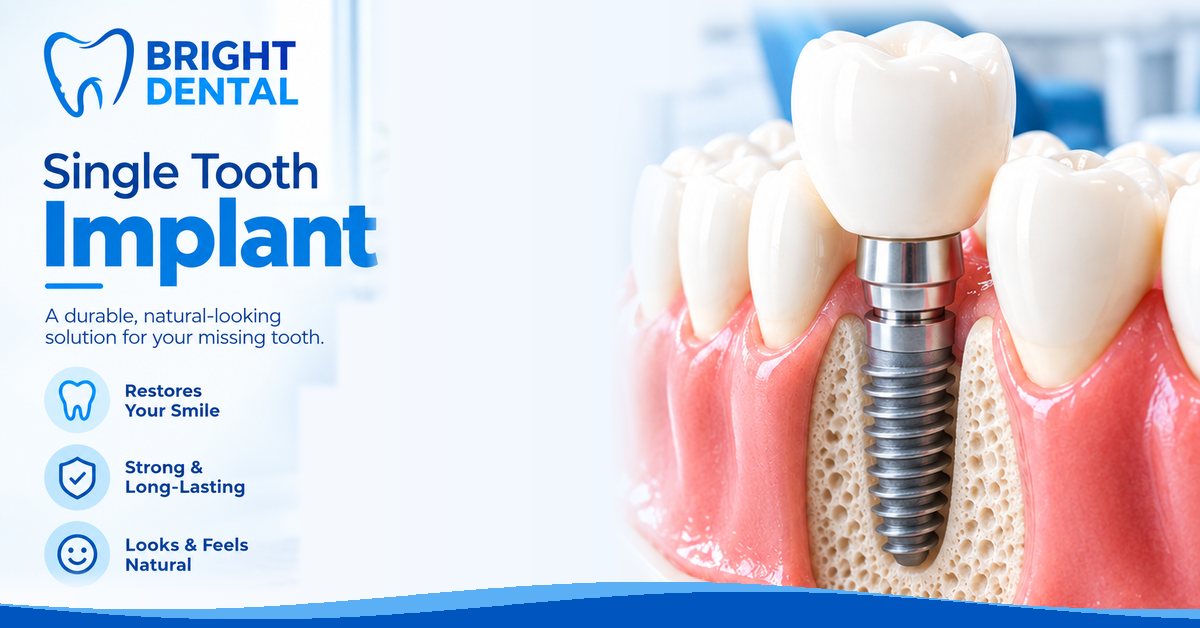 Single Tooth Implant: Procedure, Cost & Recovery Guide