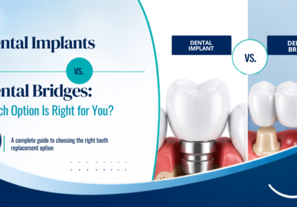 Side-by-side comparison of a dental implant and a dental bridge for missing tooth replacemen