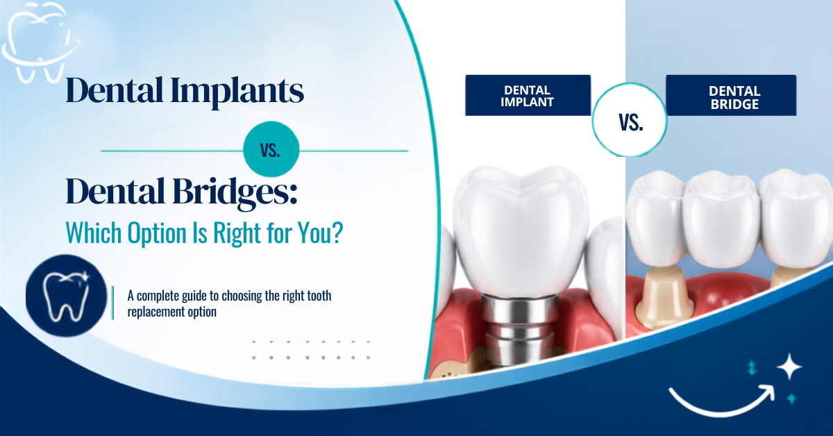 Side-by-side comparison of a dental implant and a dental bridge for missing tooth replacemen