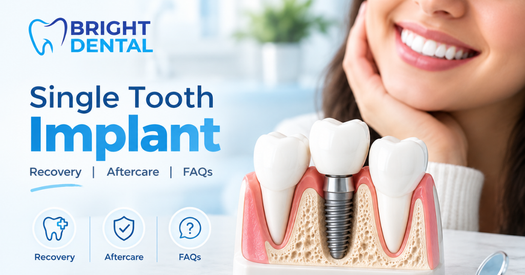 single tooth implant at bright dental clinic