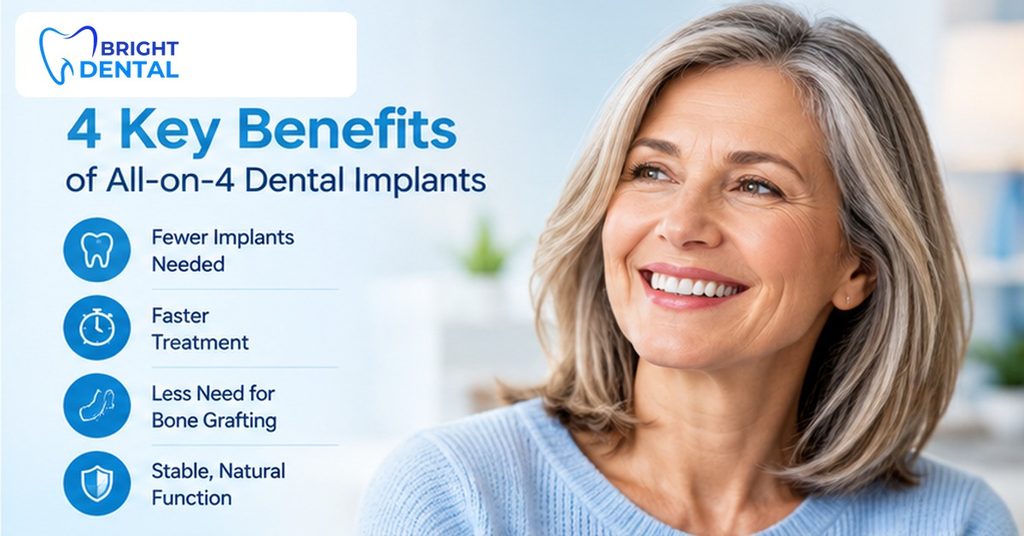 Four benefits of this full-arch implant treatment