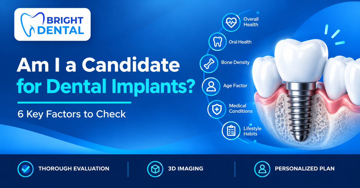 Featured image for “Am I a Candidate for Dental Implants?” showing a dental implant with six factors: overall health, oral health, bone density, age, medical conditions and lifestyle habits