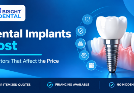 Dental implants cost guide showing 7 factors that affect pricing