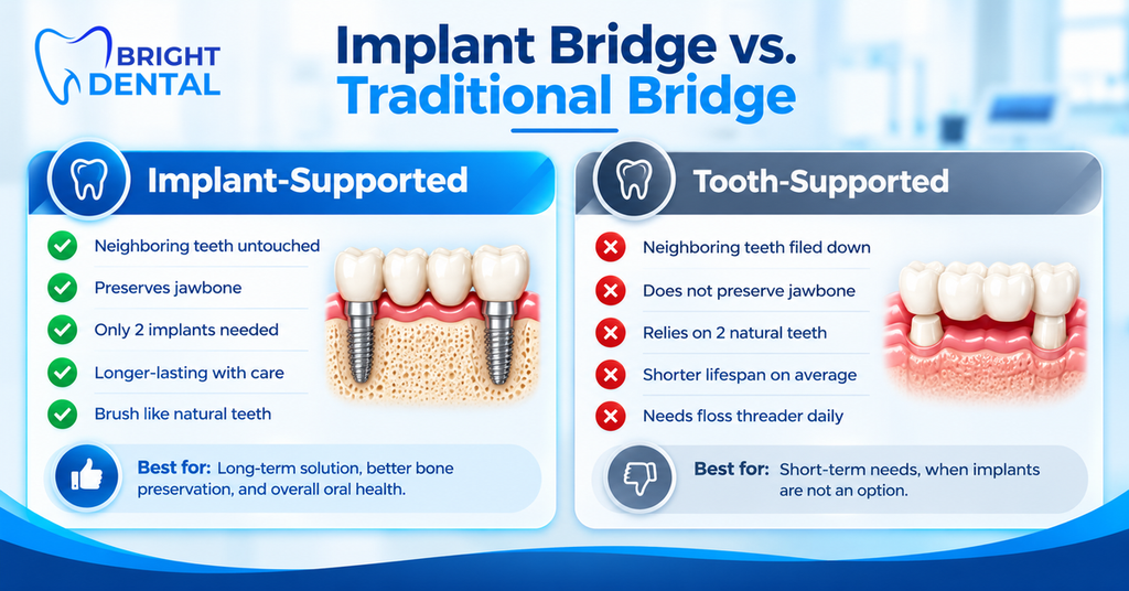 Implant-supported bridge vs. traditional tooth-supported bridge comparison