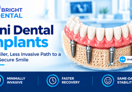 Mini dental implants supporting a lower denture, with four narrow implants placed in the jawbone