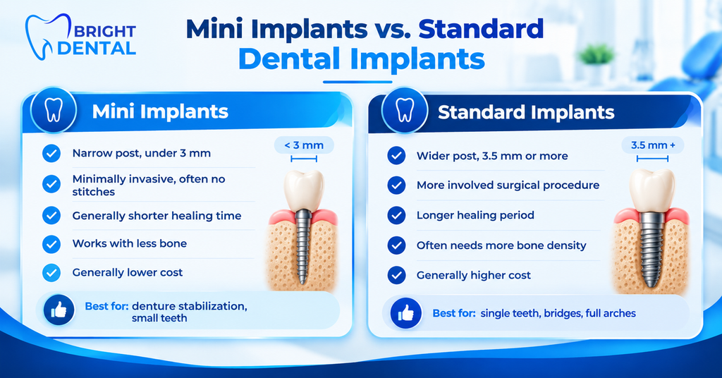 Comparison chart of mini implants versus standard dental implants, covering post width, surgery, healing time, bone needs and cost